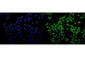 anti-SAM Domain and HD Domain 1 (SAMHD1) (AA 37-626) antibody