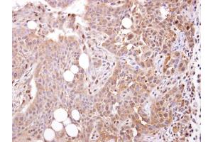 IHC-P Image STOML1 antibody [N2C3] detects STOML1 protein at cytosol on HSC-3 xenograft by immunohistochemical analysis. (STOML1 antibody)