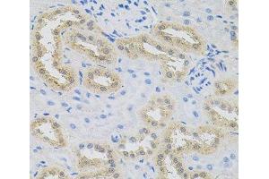 Immunohistochemistry of paraffin-embedded Rat kidney using HPS1 Polyclonal Antibody at dilution of 1:100 (40x lens). (HPS1 antibody)