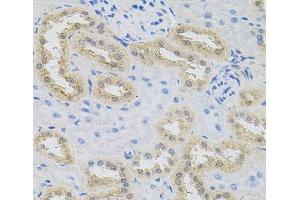 Immunohistochemistry of paraffin-embedded Rat kidney using HPS1 Polyclonal Antibody at dilution of 1:100 (40x lens).