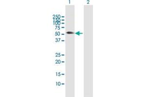 Western Blot analysis of MMP10 expression in transfected 293T cell line by MMP10 MaxPab polyclonal antibody. (MMP10 antibody  (AA 1-476))