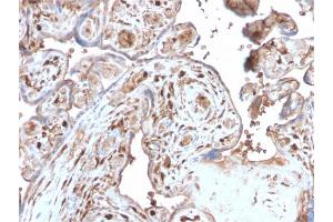 Immunohistochemistry (IHC) image for anti-S100 Calcium Binding Protein A4 (S100A4) (AA 1-200) antibody (ABIN6940545)
