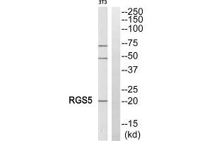 Western blot analysis of extracts from NIH/3T3 cells, using RGS5 antibody. (RGS5 antibody  (Internal Region))