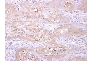 IHC-P Image Adenylate kinase 1 antibody [N1C3] detects Adenylate kinase 1 protein at cytosol on Ca922 xenograft by immunohistochemical analysis. (Adenylate Kinase 1 antibody)