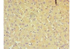 Immunohistochemistry of paraffin-embedded human liver tissue using ABIN7149648 at dilution of 1:100 (ALDH4A1 antibody  (AA 354-563))
