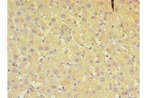 Immunohistochemistry of paraffin-embedded human liver tissue using ABIN7149648 at dilution of 1:100 (ALDH4A1 antibody  (AA 354-563))