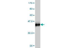 Western Blotting (WB) image for anti-serine/threonine Kinase 38 (STK38) (AA 365-465) antibody (ABIN564919)
