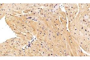 Immunohistochemistry analysis of paraffin-embedded mouse heart using,Nebulette (ABIN7074788) at dilution of 1: 1000 (Nebulette antibody)