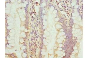Immunohistochemistry of paraffin-embedded human small intestine tissue using ABIN7172749 at dilution of 1:100 (Protein C8orf4 (TCIM) (AA 1-106) antibody)