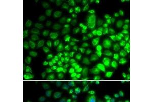Immunofluorescence analysis of HeLa cells using ST6GAL1 Polyclonal Antibody (ST6GAL1 antibody)
