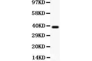 Western Blotting (WB) image for anti-V-Crk Sarcoma Virus CT10 Oncogene Homolog (Avian) (CRK) (AA 2-246) antibody (ABIN3042758)