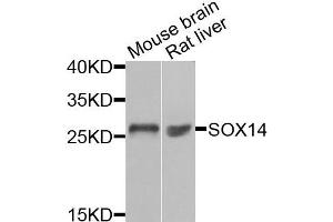 Western blot analysis of extracts of mouse brain and rat liver cells, using SOX14 antibody.