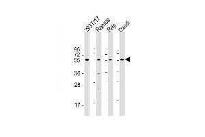 Western Blot at 1:2000 dilution Lane 1: 293T/17 whole cell lysate Lane 2: Ramos whole cell lysate Lane 3: Raji whole cell lysate Lane 4: Daudi whole cell lysate Lysates/proteins at 20 ug per lane. (FCRL4 antibody  (C-Term))