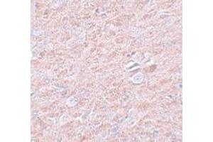 Immunohistochemistry (IHC) image for anti-PR Domain Containing 16 (PRDM16) (C-Term) antibody (ABIN1030598) (PRDM16 antibody  (C-Term))