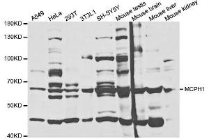 Western Blotting (WB) image for anti-Microcephalin 1 (MCPH1) antibody (ABIN1876660)
