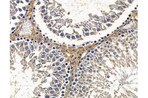 anti-TBC1 Domain Family, Member 9 (With GRAM Domain) (TBC1D9) antibody