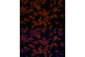 Immunofluorescence analysis of C6 cells using PRX antibody (ABIN7269215) at dilution of 1:100. (Periaxin antibody  (AA 1250-1350))