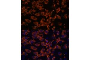 Immunofluorescence analysis of C6 cells using PRX antibody (ABIN7269215) at dilution of 1:100. (Periaxin antibody  (AA 1250-1350))