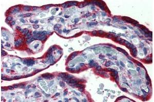 Human, Placenta: Formalin-Fixed Paraffin-Embedded (FFPE) (ERP44 antibody  (C-Term))