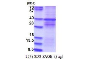 SDS-PAGE (SDS) image for Dual-Specificity tyrosine-(Y)-phosphorylation Regulated Kinase 1A (DYRK1A) (AA 159-479) protein (His tag) (ABIN5853755) (DYRK1A Protein (AA 159-479) (His tag))