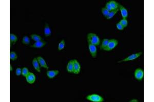Immunofluorescent analysis of HepG2 cells using ABIN7146589 at dilution of 1:100 and Alexa Fluor 488-congugated AffiniPure Goat Anti-Rabbit IgG(H+L) (Calsyntenin 2 antibody  (AA 473-673))