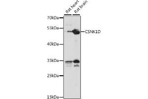 Western blot analysis of extracts of various cell lines, using CSNK1D antibody (ABIN7266100) at 1:1000 dilution. (Casein Kinase 1 delta antibody  (AA 250-350))