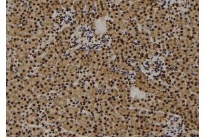 ABIN6273457 at 1/100 staining Mouse kidney tissue by IHC-P. (CENPF antibody  (C-Term))