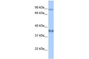 WB Suggested Anti-ZFP64 Antibody Titration:  0. (ZFP64 antibody  (Middle Region))