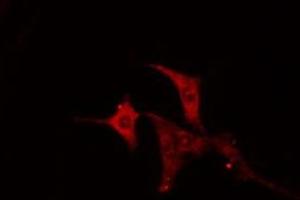ABIN6274992 staining NIH-3T3 cells by IF/ICC. (Cep76 antibody  (Internal Region))