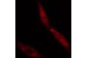 ABIN6274978 staining  Hela cells by IF/ICC. (CNOT4 antibody  (N-Term))