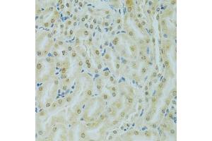 Immunohistochemistry of paraffin-embedded mouse kidney using RCC1 antibody (ABIN5973761) at dilution of 1/100 (40x lens). (RCC1 antibody)