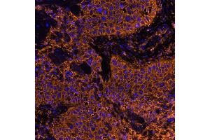 Immunofluorescence (IF) image for anti-CD44 (CD44) (AA 700-742) antibody (ABIN7454002) (Recombinant CD44 antibody  (AA 700-742))