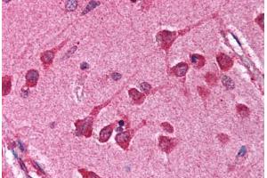 Human Brain, Cortex (formalin-fixed, paraffin-embedded) stained with NFKBIA antibody ABIN218609 at 1:1000 followed by biotinylated goat anti-rabbit IgG secondary antibody ABIN481713, alkaline phosphatase-streptavidin and chromogen. (NFKBIA antibody  (C-Term))