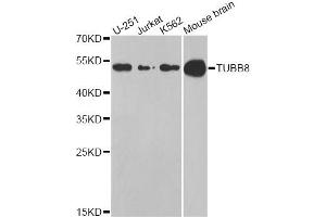 Western blot analysis of extracts of various cell lines, using TUBB8 antibody (ABIN5974843) at 1/1000 dilution.