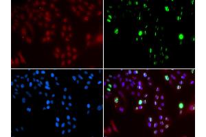Immunofluorescence analysis of GFP-RNF168 transgenic U2OS cells using FANCD2 antibody (ABIN5971101).