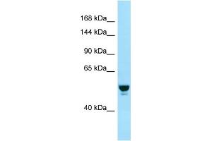 Western Blotting (WB) image for anti-RAB GTPase Activating Protein 1 (RABGAP1) (N-Term) antibody (ABIN2774440) (RABGAP1 antibody  (N-Term))