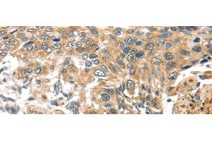 TTI1 antibody