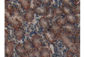 Detection of MAP1A in Mouse Kidney Tissue using Polyclonal Antibody to Microtubule Associated Protein 1A (MAP1A)