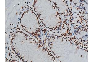 ABIN6267568 at 1/200 staining human colon tissue sections by IHC-P. (Histone 3 antibody  (H3K9ac))