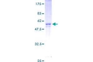 CNOT8 Protein (AA 1-292) (GST tag)