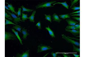 Immunofluorescence of purified MaxPab antibody to SH3GLB2 on HeLa cell. (SH3GLB2 antibody  (AA 1-395))
