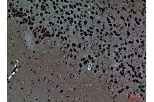 Immunohistochemical analysis of paraffin-embedded Mouse-brain, antibody was diluted at 1:100. (Pleiotrophin antibody  (Internal Region))