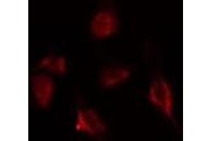 ABIN6275397 staining  293 cells by IF/ICC. (DDX20 antibody  (Internal Region))