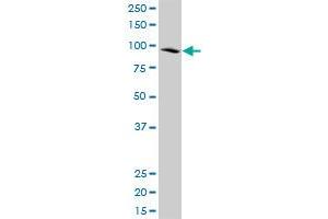 CDC5L polyclonal antibody (A01), Lot # 060814QCS1. (CDC5L antibody  (AA 719-802))
