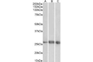 ABIN4902613 (1µg/ml) staining of Heart (A), Kidney (B) and Lung (C) lysates (35µg protein in RIPA buffer). (EGFL7 antibody)