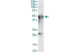 Immunoprecipitation of PORCN transfected lysate using anti-PORCN MaxPab rabbit polyclonal antibody and Protein A Magnetic Bead , and immunoblotted with . (PORCN antibody  (AA 1-450))