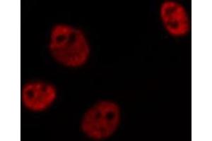 ABIN6269383 staining HeLa cells by IF/ICC. (ATRIP antibody  (N-Term))