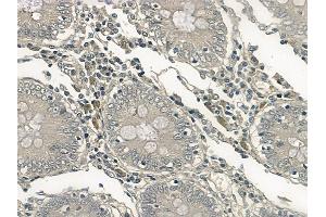 ABIN6256682 and ABIN6267213 at 1/100 staining human normal colon tissue by IHC-P. (CDK6 antibody  (pTyr24))