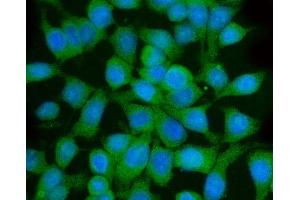 anti-Golgi-Associated, gamma Adaptin Ear Containing, ARF Binding Protein 3 (GGA3) (AA 7-535) antibody