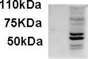 AP22454PU-N AIM2 antibody staining of IFNbeta-treated WI-38 lysate (35µg protein in RIPA buffer). (AIM2 antibody  (C-Term))